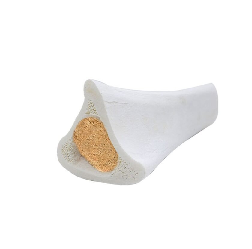Tibia Bone Filled With Bully